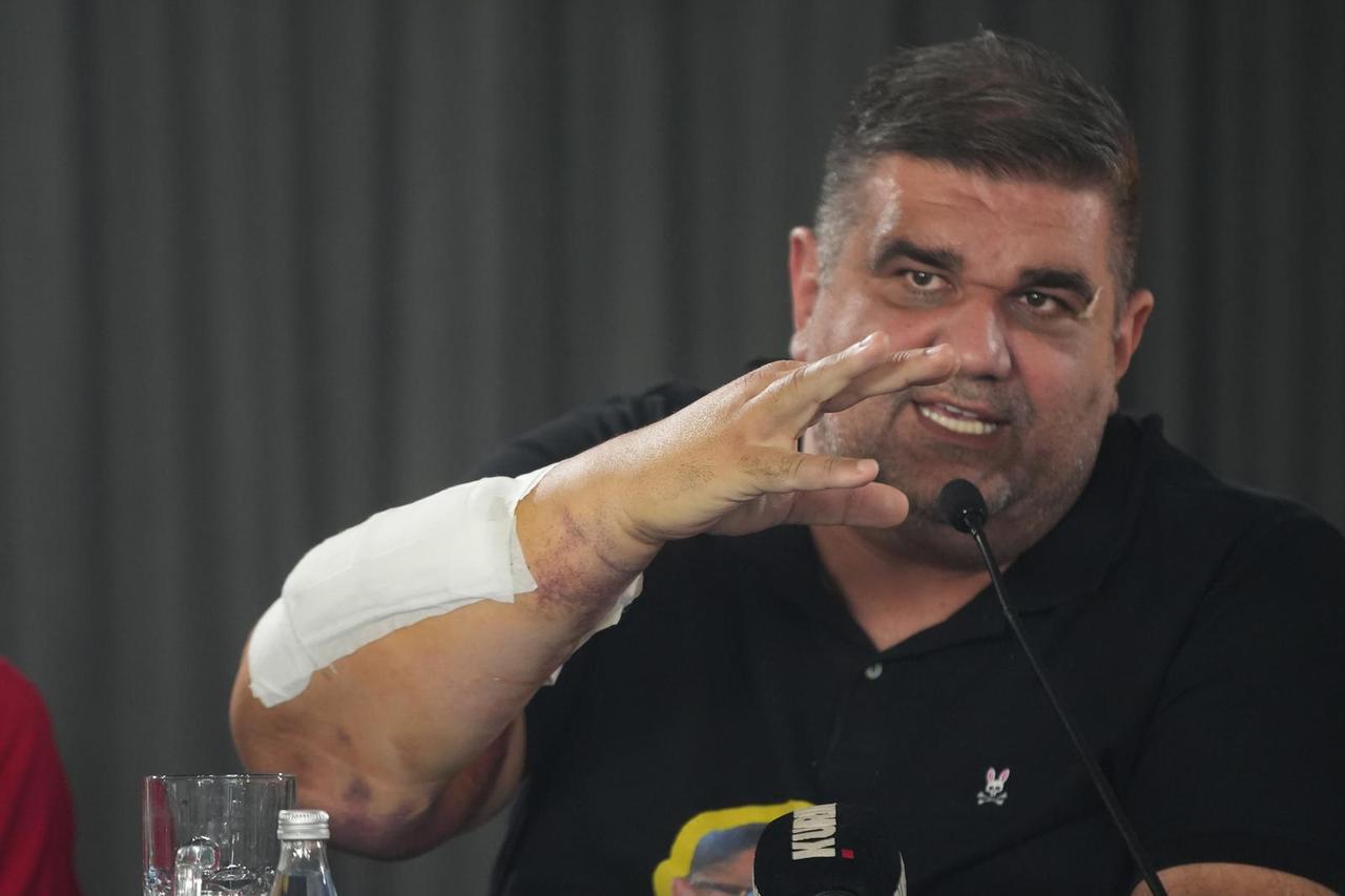 Beograd: Vlasnik Hype produkcije i Hype televizije, Saša Mirković na konferenciji je progovorio o napadu